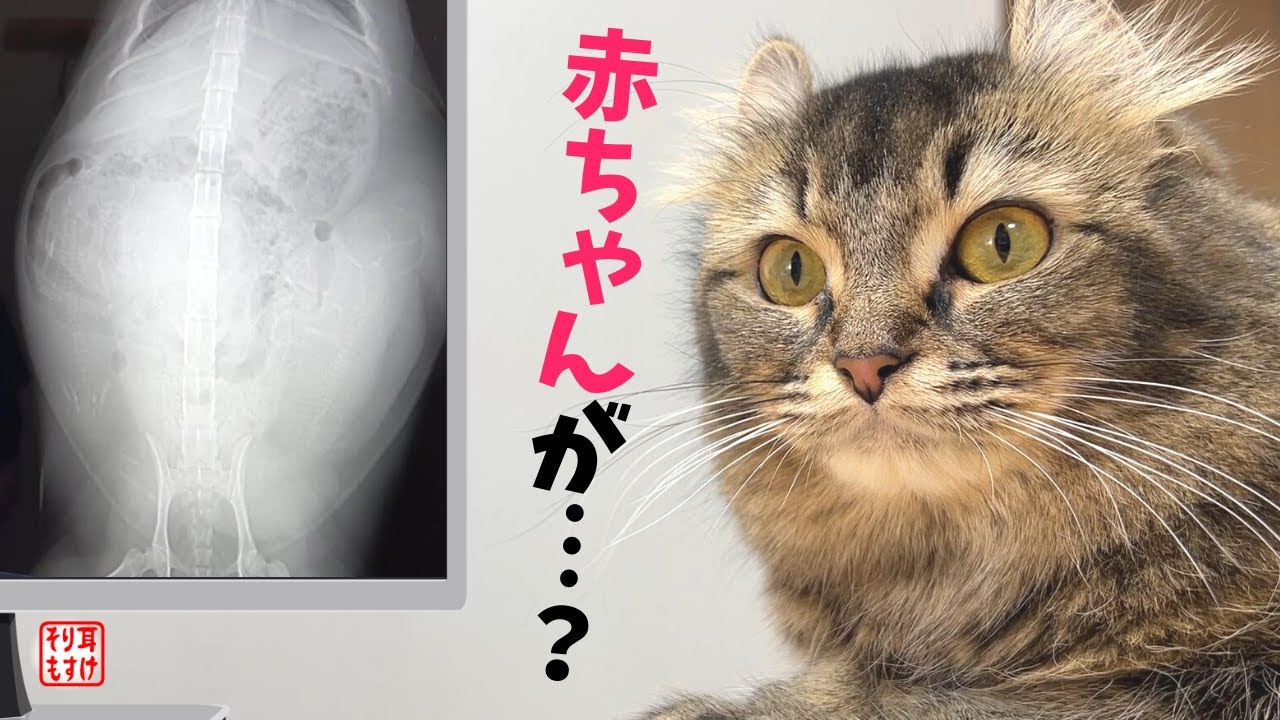 正直…驚きました。妊娠レントゲン検査で予想外の結果が…