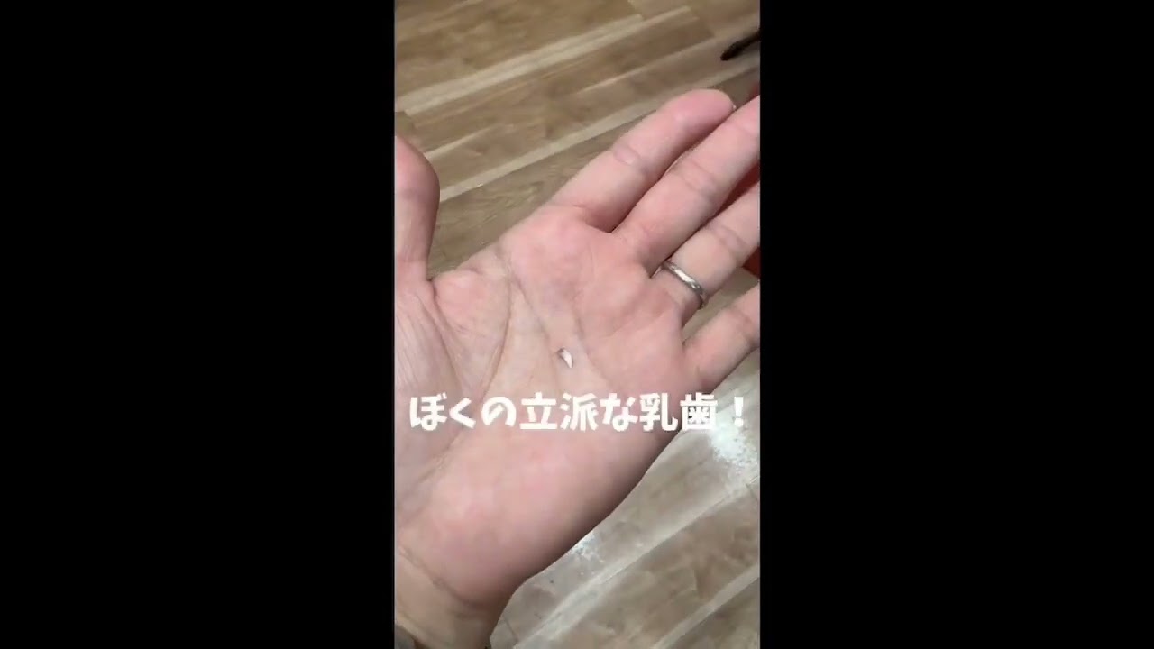 シンガプーラくん乳歯抜けて生え変わりました！