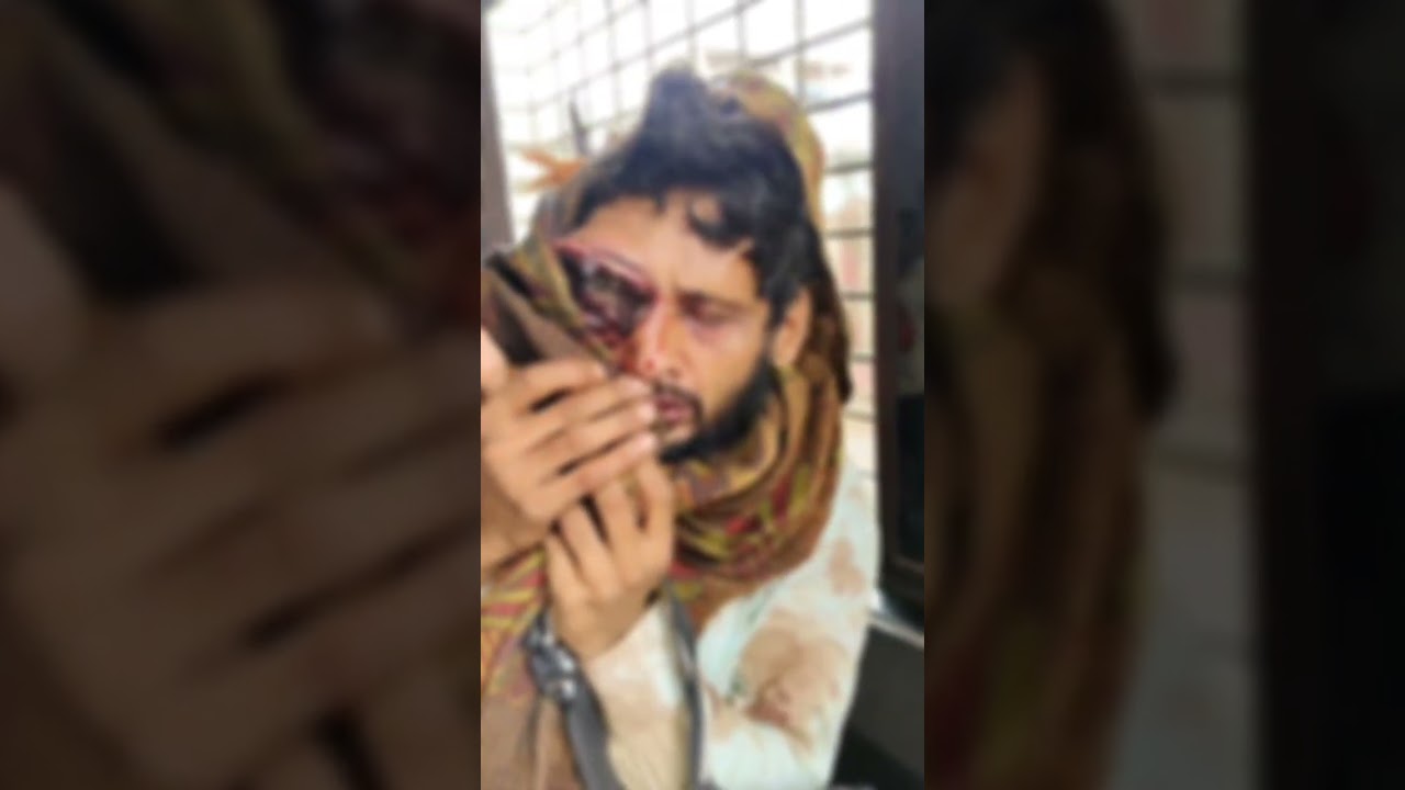 Mumbai case 🥺#views #virelvideo #shots #share #help #helping #humanrights #humanity #pain #youtuber