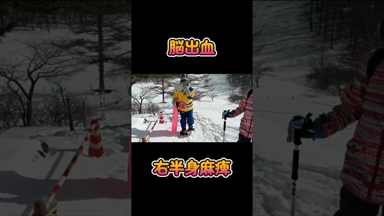 脳出血後に初スノーシューと雪遊び①　#shorts #脳出血 #ボーダーコリー #犬とお出かけ #ハイエース #夫婦 #スノーシュー